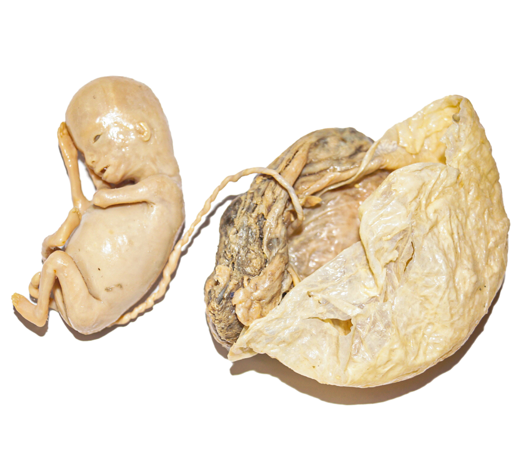 plastinated embryo